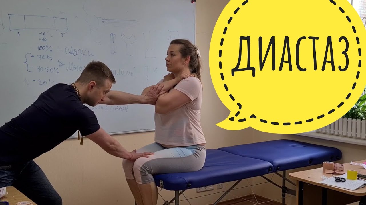 Диастаз. Тейпирование, мышечный тест живота. Прикладная кинезиология, семинар.