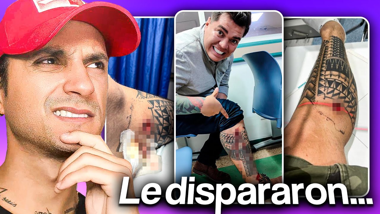 LE DISPARARON en UNA PIERNA por ROBARLO | Anecdatario | El Muñe