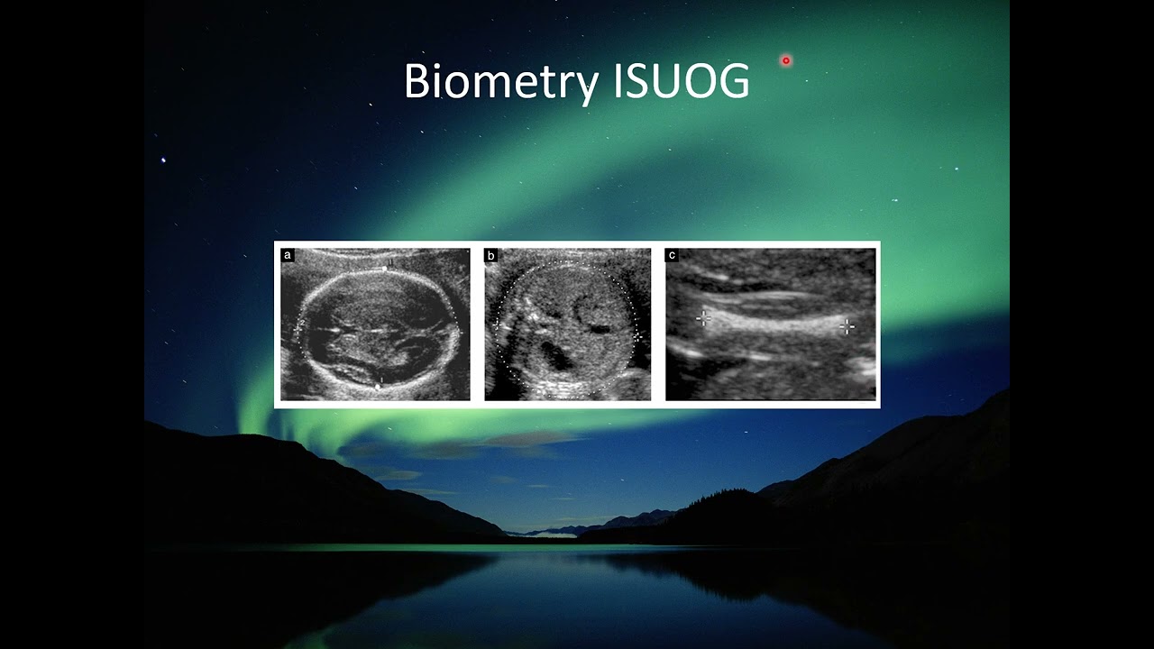 Second Trimester Fetal Ultrasound Protocol