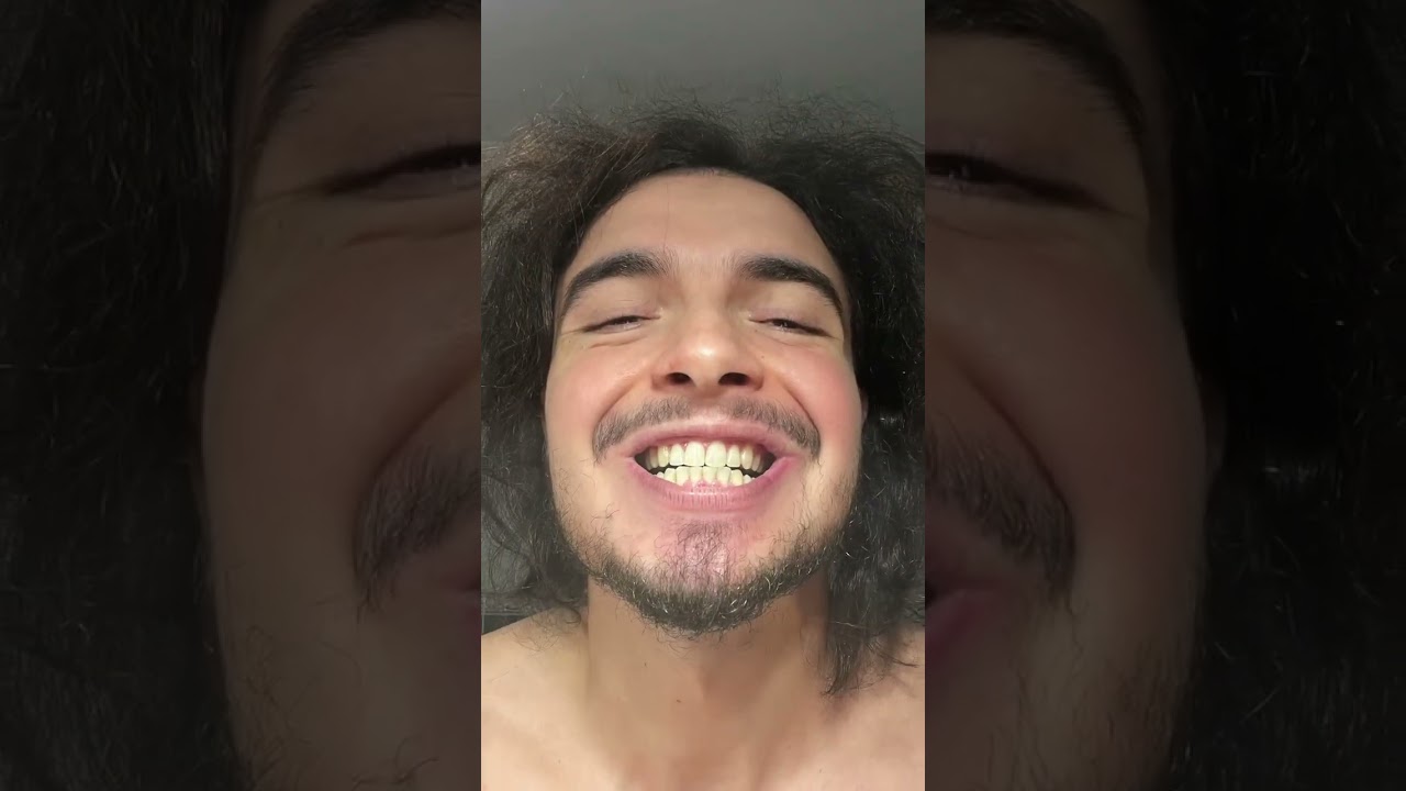 DENTS BLANCHES = ARNAQUE 💰 ??? JE TEST LE BLANCHIMENT 🦷