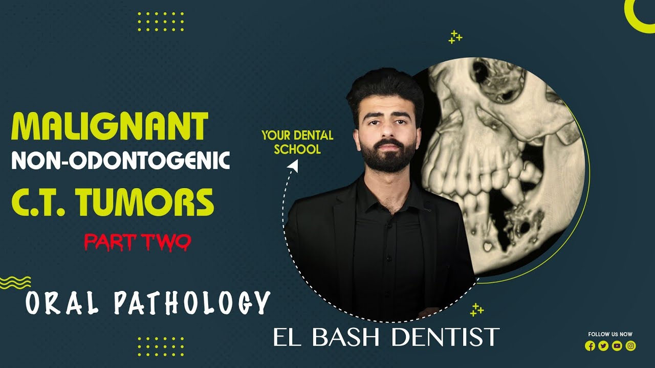 malignant ct tumors _ part 2 || oral pathology || عزت شومان
