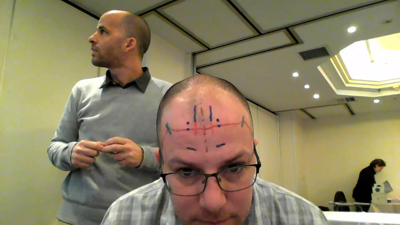 YNSA Brain Point location/ David Bomzon & Avi Amir