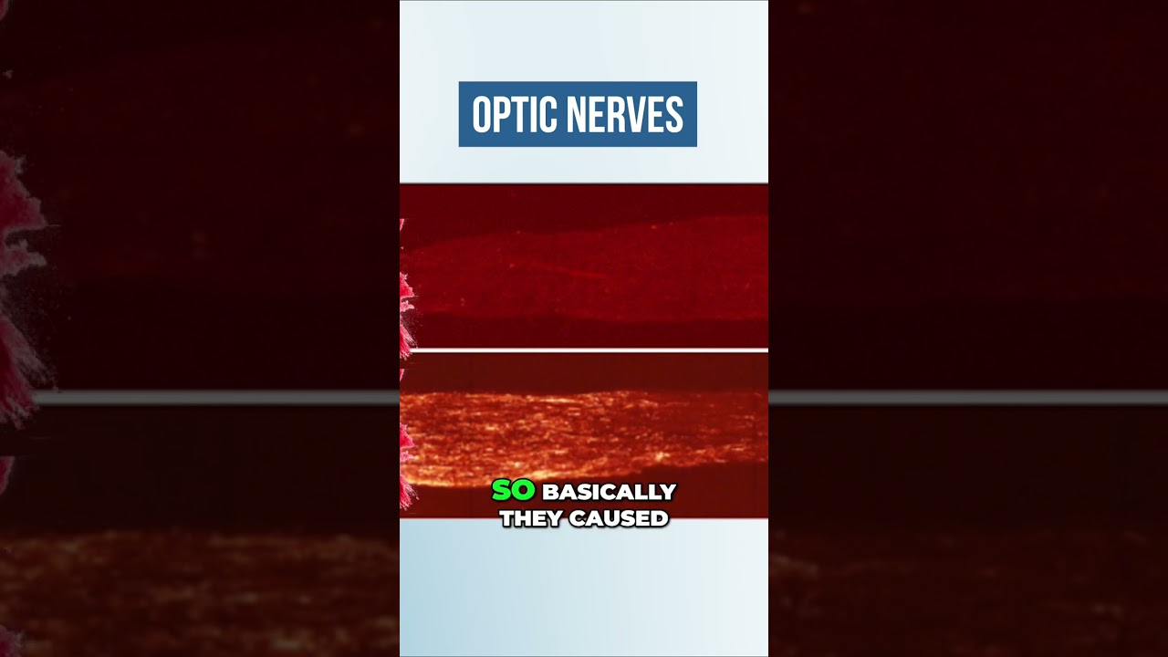 Revolutionary Experiment  Regenerating Optic Nerves After Injury
