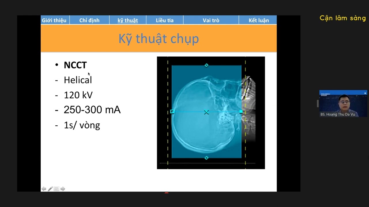 CT TRONG ĐỘT QUỴ CẤP | ThS. BS. Hoàng Thu Dạ Vũ