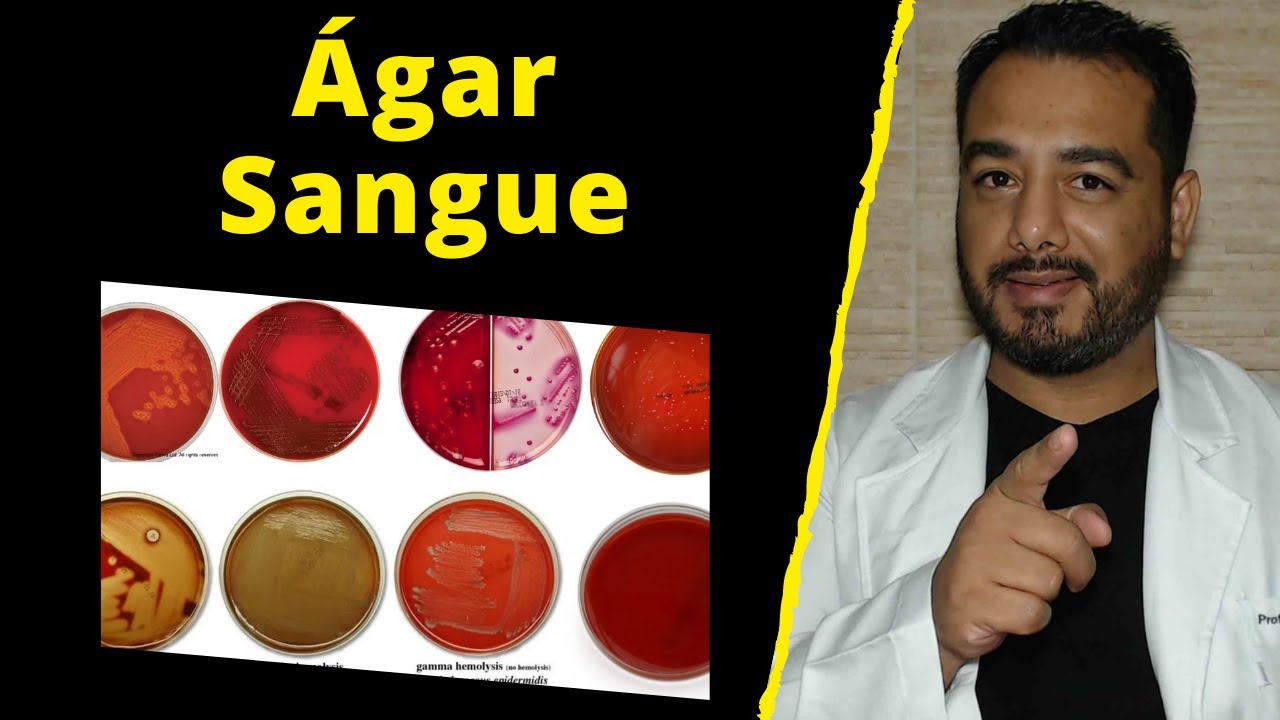 12) Ágar Sangue | Hemólise | Meio de Cultura | Microbiologia | Questões Comentadas Concurso Público