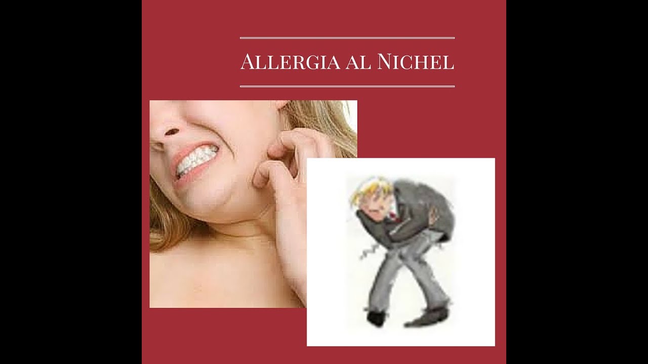 Intolleranza al nichel: linee guida