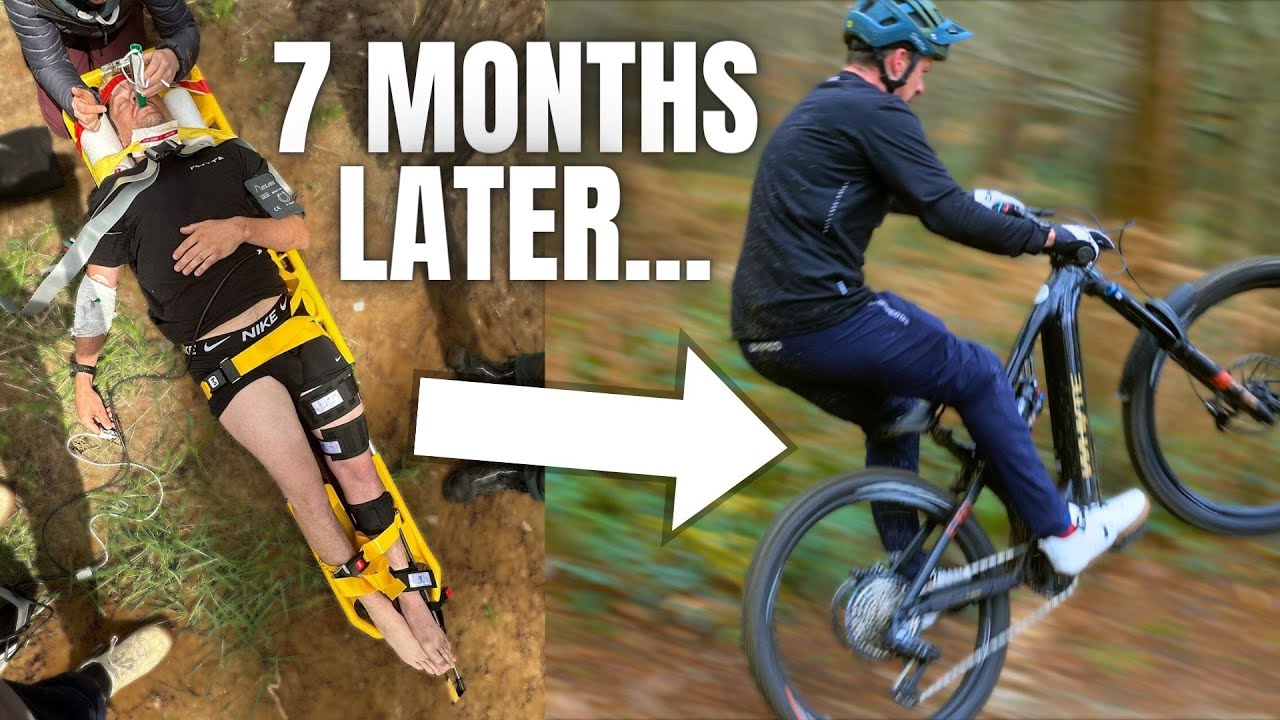 Broken Femur Recovery | Daryl Brown