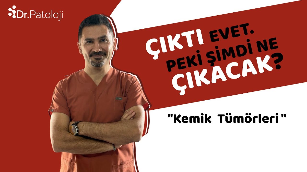 Çıktı Evet Peki Şimdi Ne çıkacak? I  Kemik Tümörleri