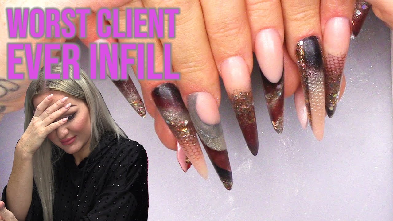 3D Acrylic Infill on The Worst Client Ever - Fay's Fave's Infill