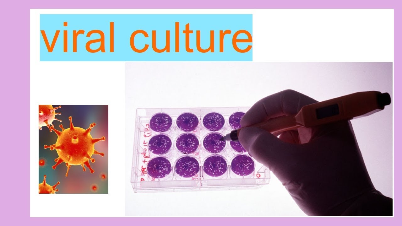 viral culture