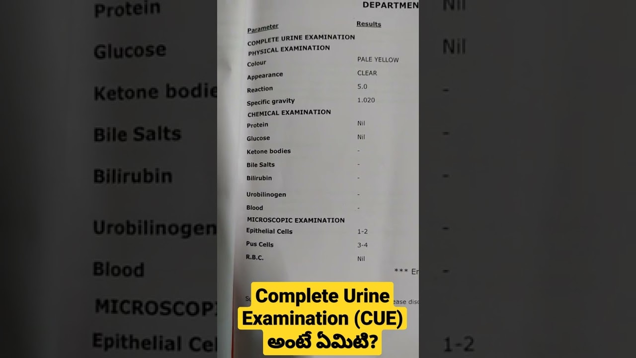 Complete Urine Examination (CUE) అంటే ఏమిటి? Dr Sai Chandra