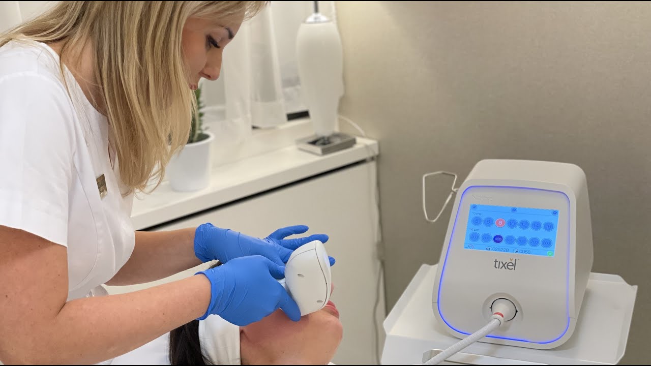 Odmłodzenie i rewitalizacja skóry twarzy w technologii Tixel 2. Premiera urządzenia w Sharley Clinic