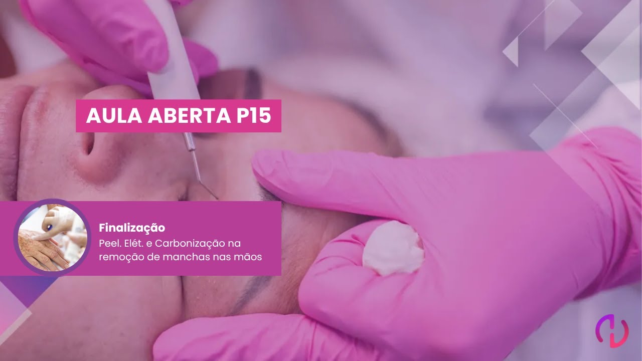 Aula Aberta #P15 - Finalização - Carbonização na Remoção de Manchas nas Mãos