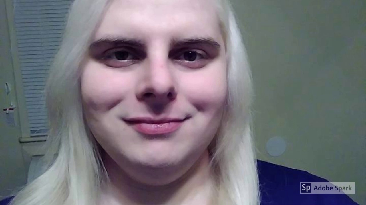 Transition Timeline | 15 Months on HRT