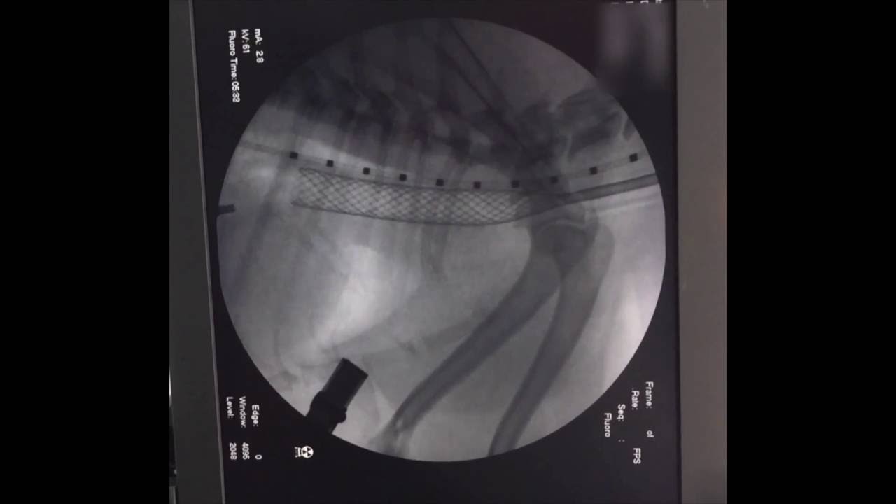【最新】犬の気管虚脱（気管ステント設置術）＿松波動物病院メディカルセンター