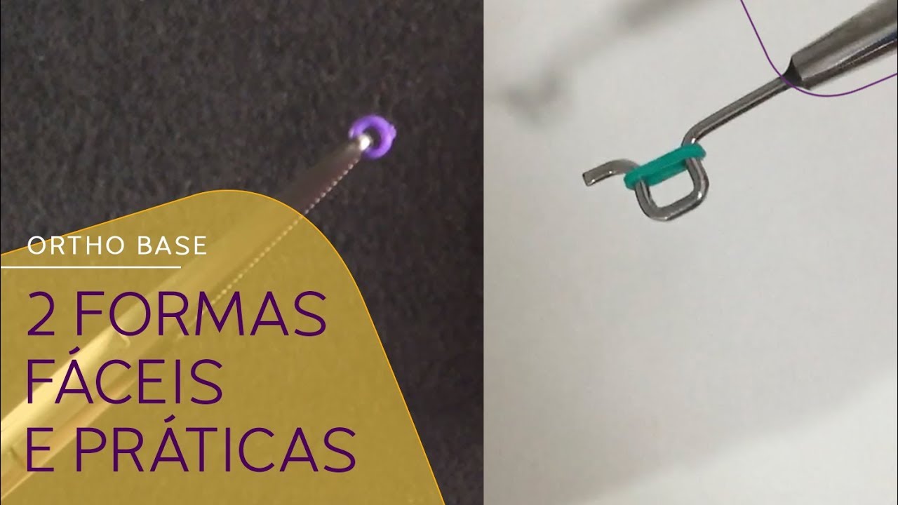 Como colocar a ligadura elástica no aparelho ortodôntico?