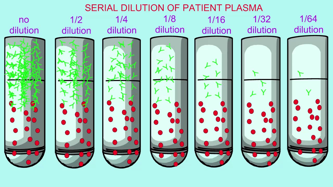 immunoassay with precipitin forming in tubes