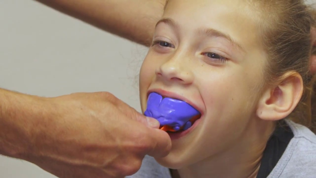 Tuto prise d'empreinte pour protège dents sur mesure prochocs ENFANT