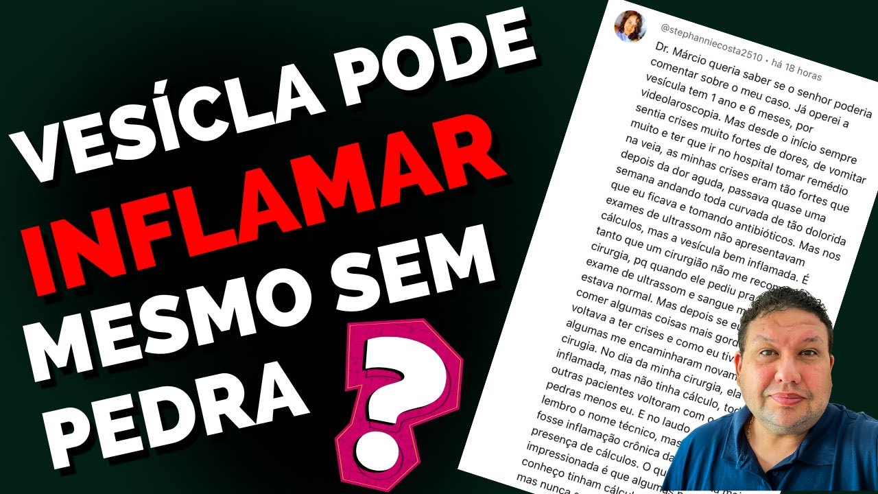 VESÍCULA BILIAR INFLAMADA SEM PEDRA NA VESÍCULA? COLECISTITE ALITIÁSICA