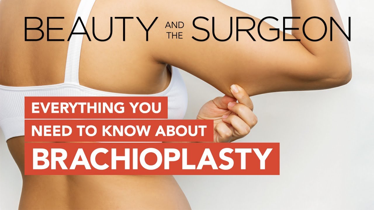 Everything You Need to Know About Brachioplasty (Arm Lift) - Beauty and the Surgeon Episode 136