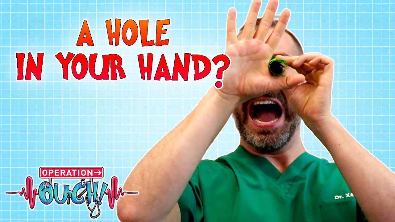 A Hole in Your Hand? | Mindbenders | Operation Ouch | Science for Kids