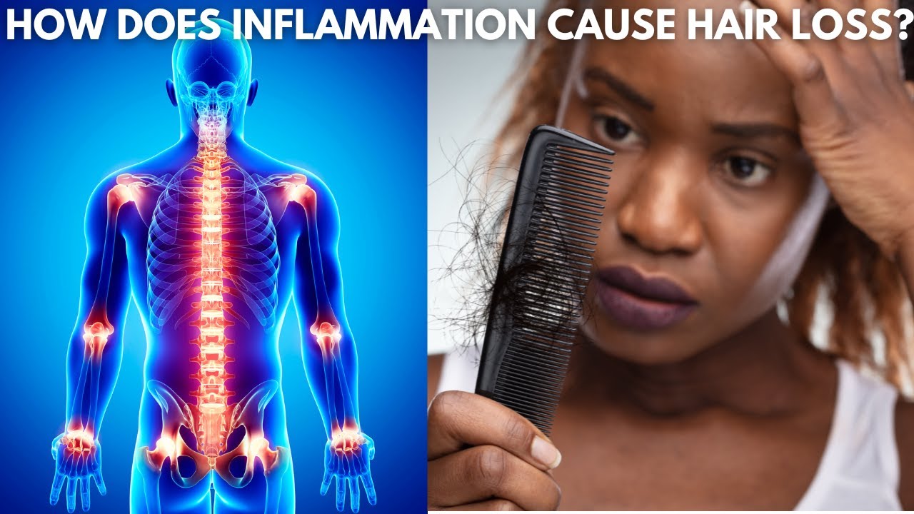 What is Inflammation & Why Does it Cause HAIR LOSS, and How to Prevent with Herbs