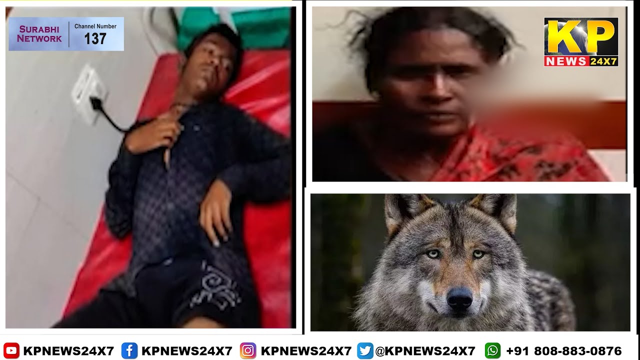 Bidar | Wolf attack: Four people including a boy injured