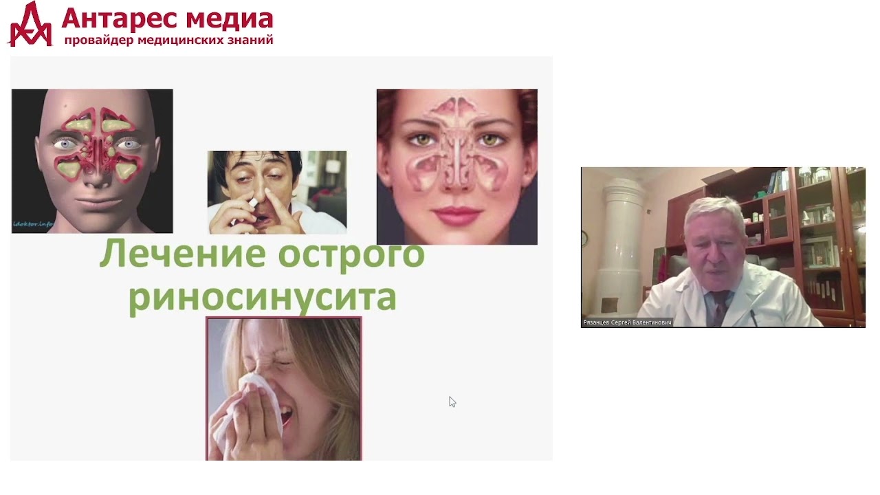 Современные стандарты лечения синуситов. лекция проф.С.В.Рязанцева 28.01.2022