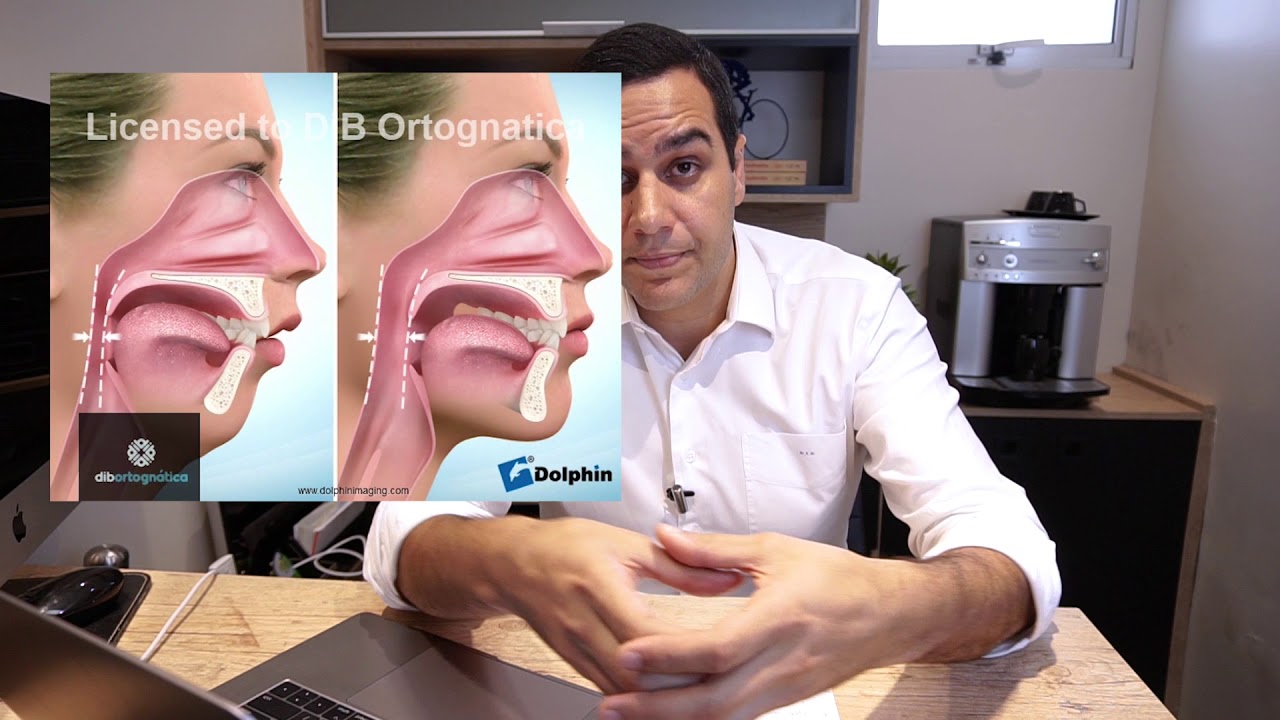 Beneficios para as vias aéreas  com a Cirurgia Ortognática