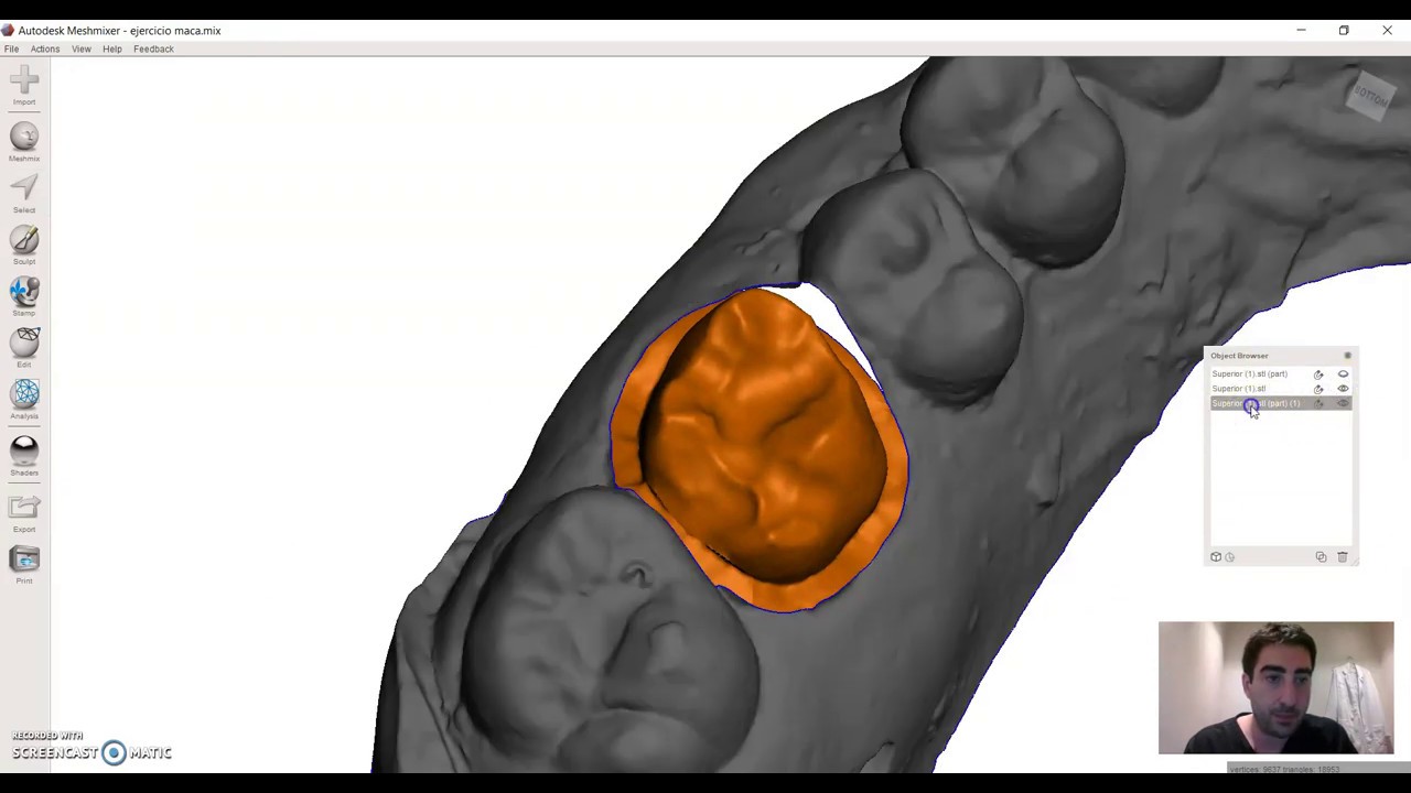 Meshmixer tutorial 13 como hacer muñones dentales