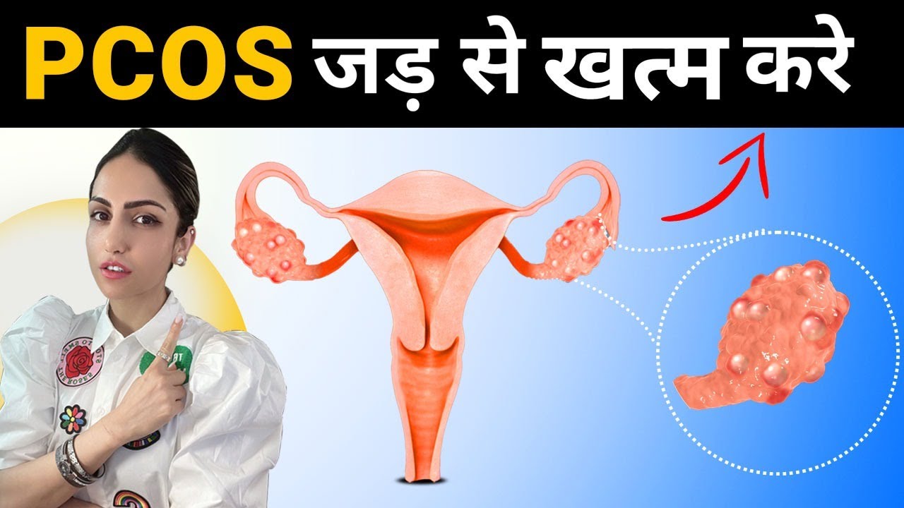 PCOS को जड़ से ख़तम करें Heal PCOS & Irregular Periods Naturally