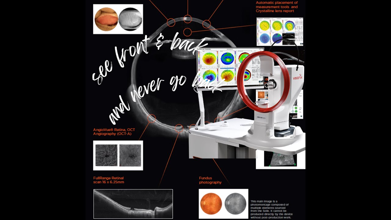 Discover the Optovue Solix by Visionix