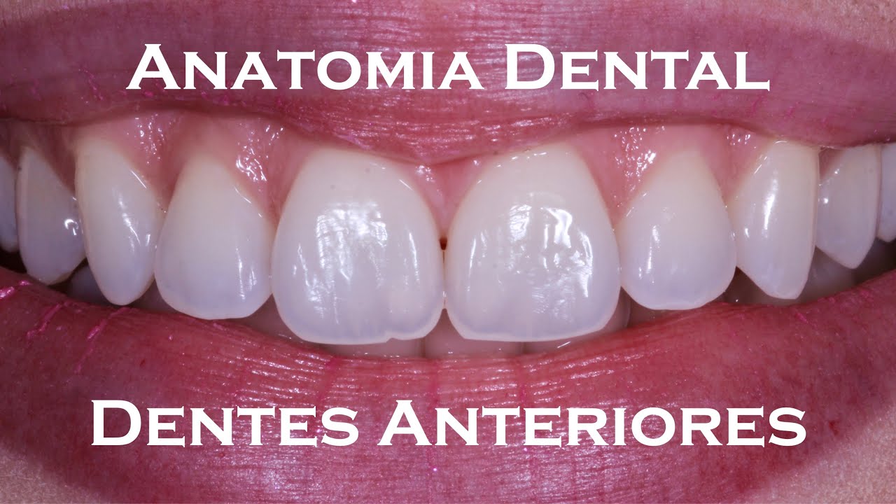 Anatomia Dental para Restaurações Estéticas | Dentes Anteriores