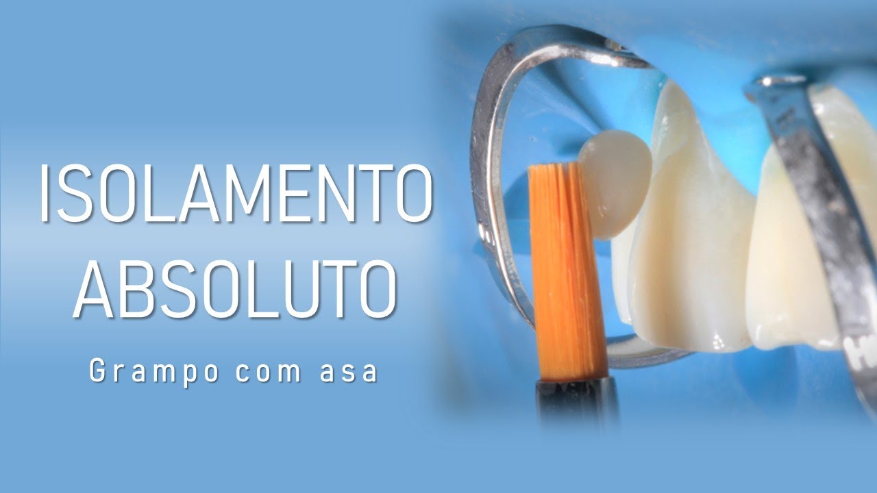 Isolamento absoluto - Grampo com asa