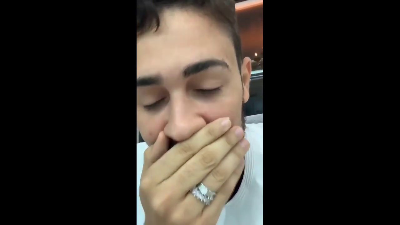 Carlinhos Maia tira lentes de contato dos dentes e mostra seu sorriso natural 😱