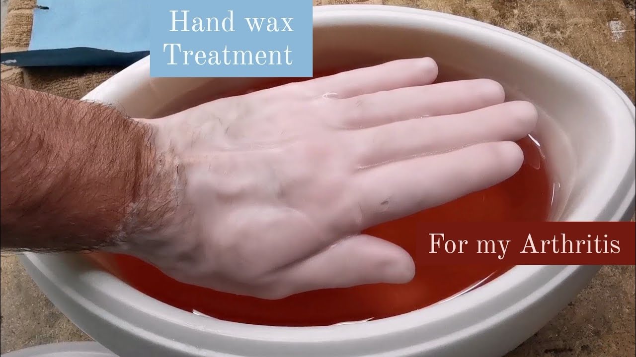 Hot wax treatment for Arthritis - Great for Woodworkers. Parrafin Wax treatment.