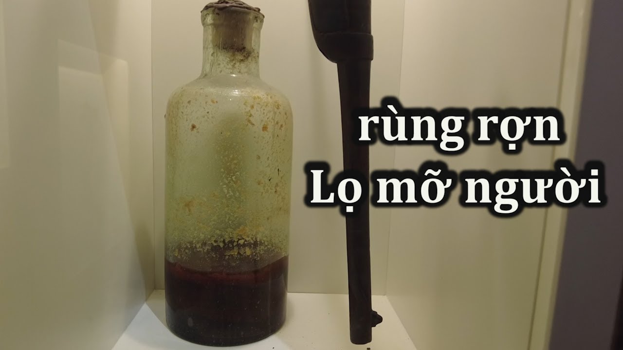 Rùng rợn lọ mỡ người ở Hà Giang.