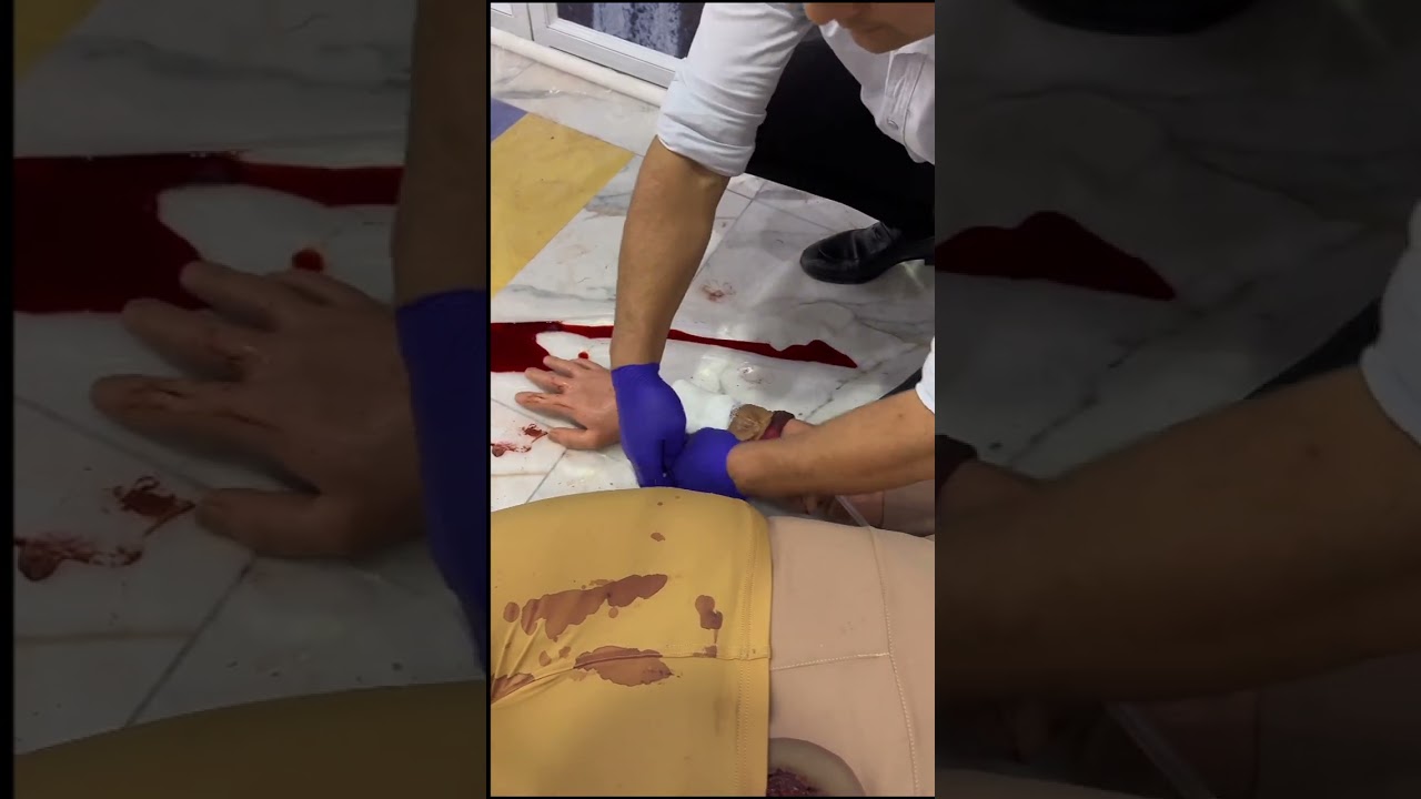 Qon ketganda birinchi yordam.  Остановка кровотечения.