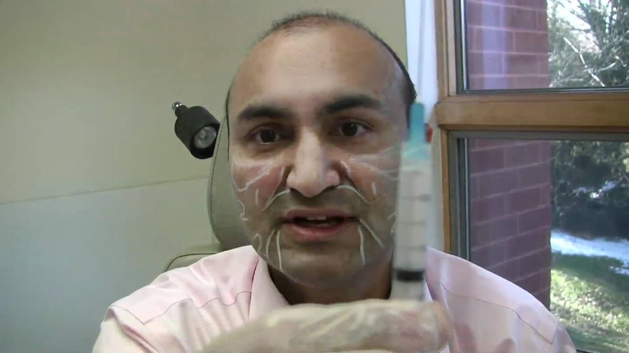 Dr. Janjua demonstrates Sculptra Injection - New Jersey