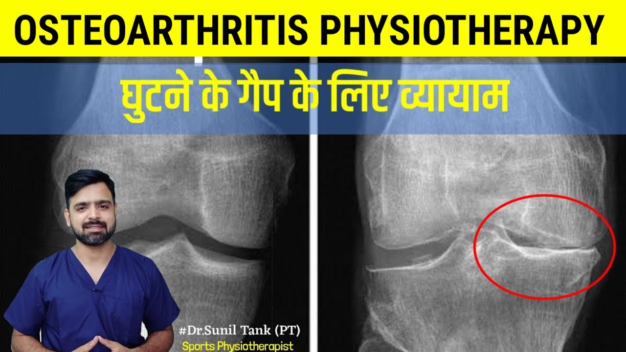 Knee gap exercises in hindi - exercise for knee pain | knee osteoarthritis pain | Dr. Sunil Tank