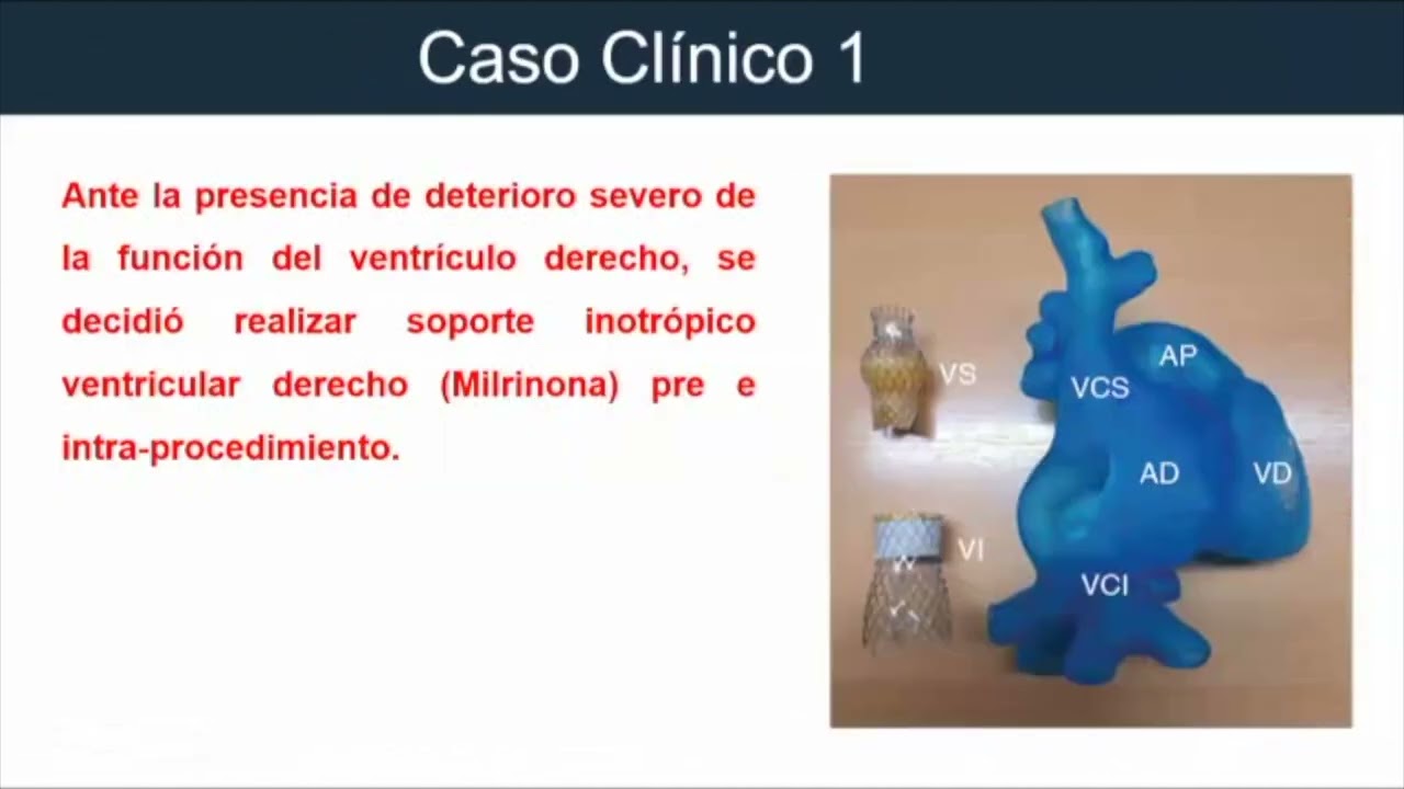 Ep 5. Tratamiento de la insuficiencia tricuspídea severa