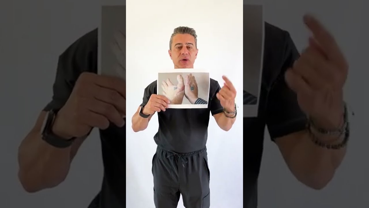 Toe vs Thumb