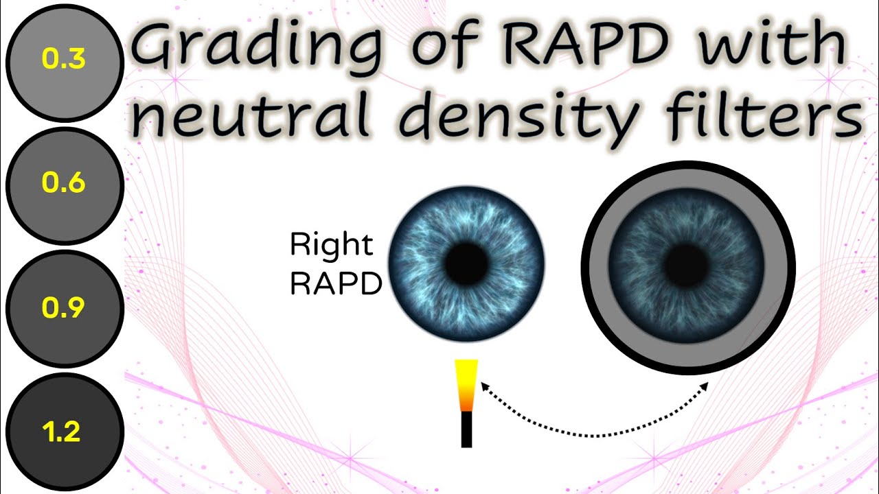 Pupil 5 | Grading of RAPD with neutral density filters