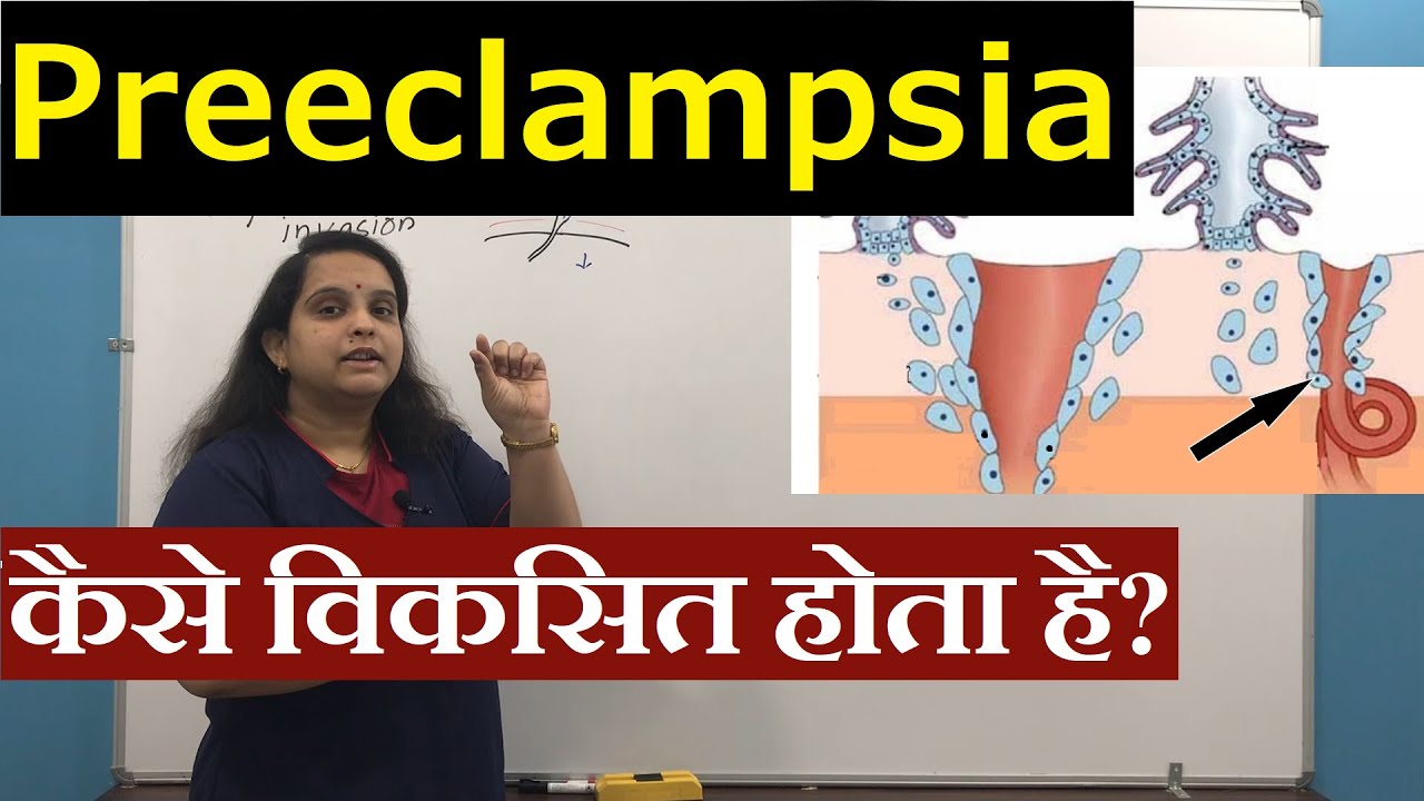 Pathogenesis of Preeclampsia in Hindi (हिंदी) | Pregnancy induced Hypertension | Nursing Lecture