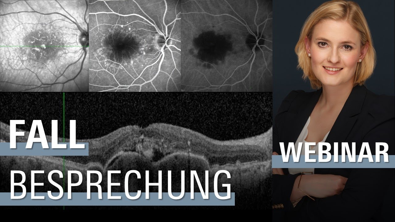🇩🇪 3. Retina Sprechstunde: Fallbesprechung | SPECTRALIS