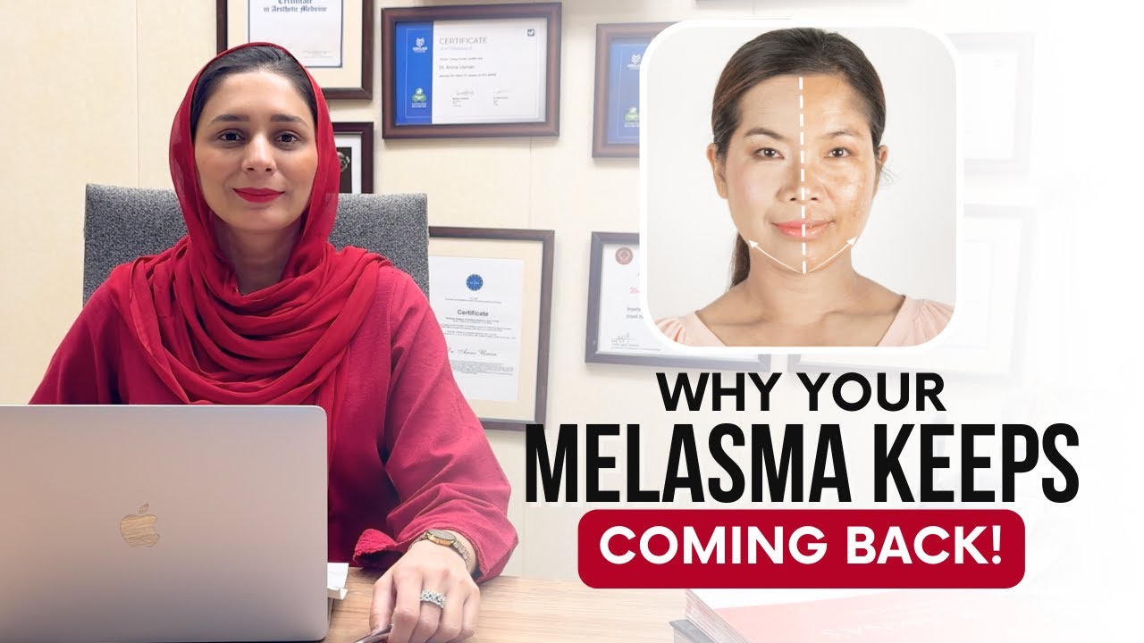 TOP 7 Reasons Why Your Melasma Isn't Improving and Keeps Coming Back