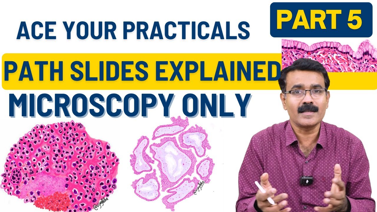 Microscopy Made Easy &ndash; Part 5: Quick Revision of Common Pathology Slides | Dr. Vijay Shankar