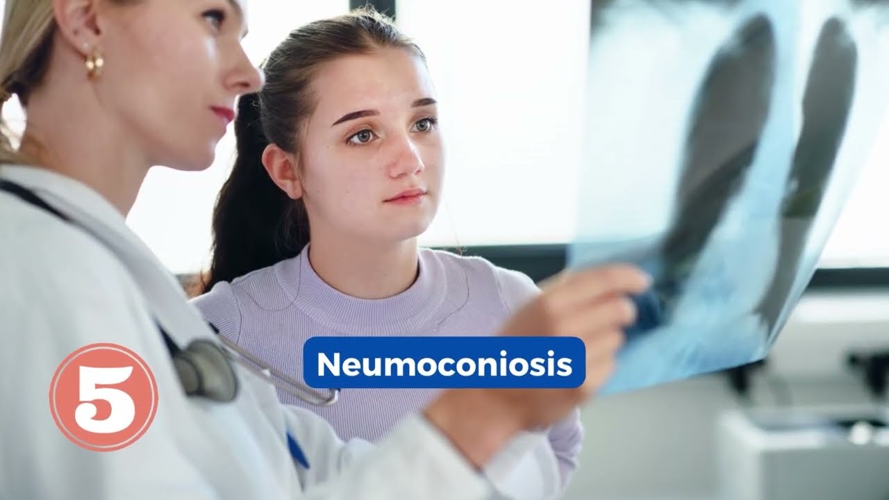 LOS 5 PUNTOS QUE DEBES SABER DE LA ENFERMEDAD PULMONAR INTERSTICIAL