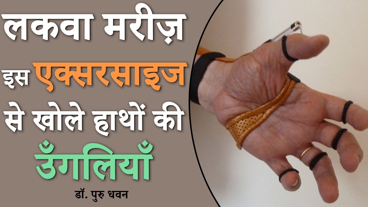 100% खुलेगी लकवा मरीज़ के हाथों की उँगलियाँ | जरूर देखें ये वीडियो
