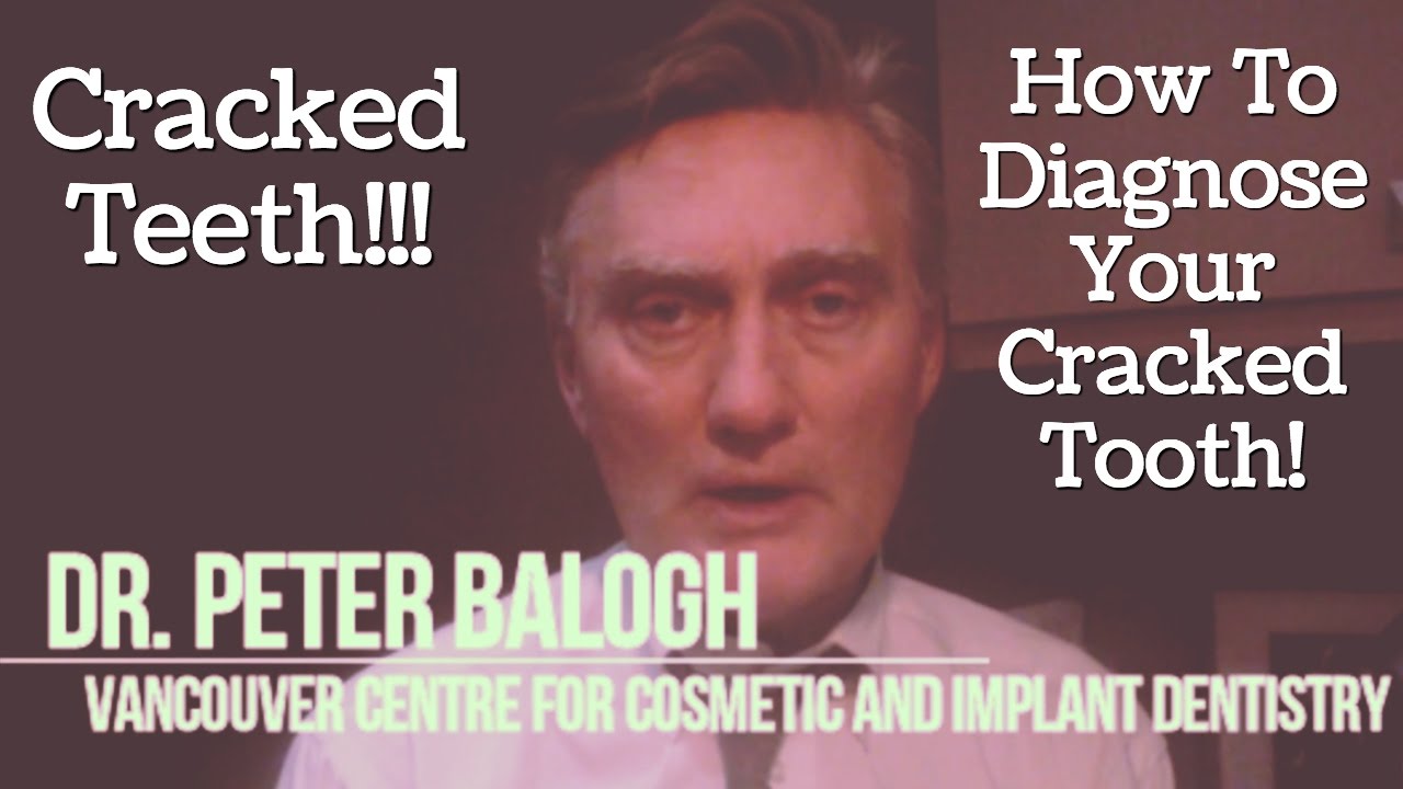 Cracked Teeth: Diagnosing Your Cracked Tooth | VCCID